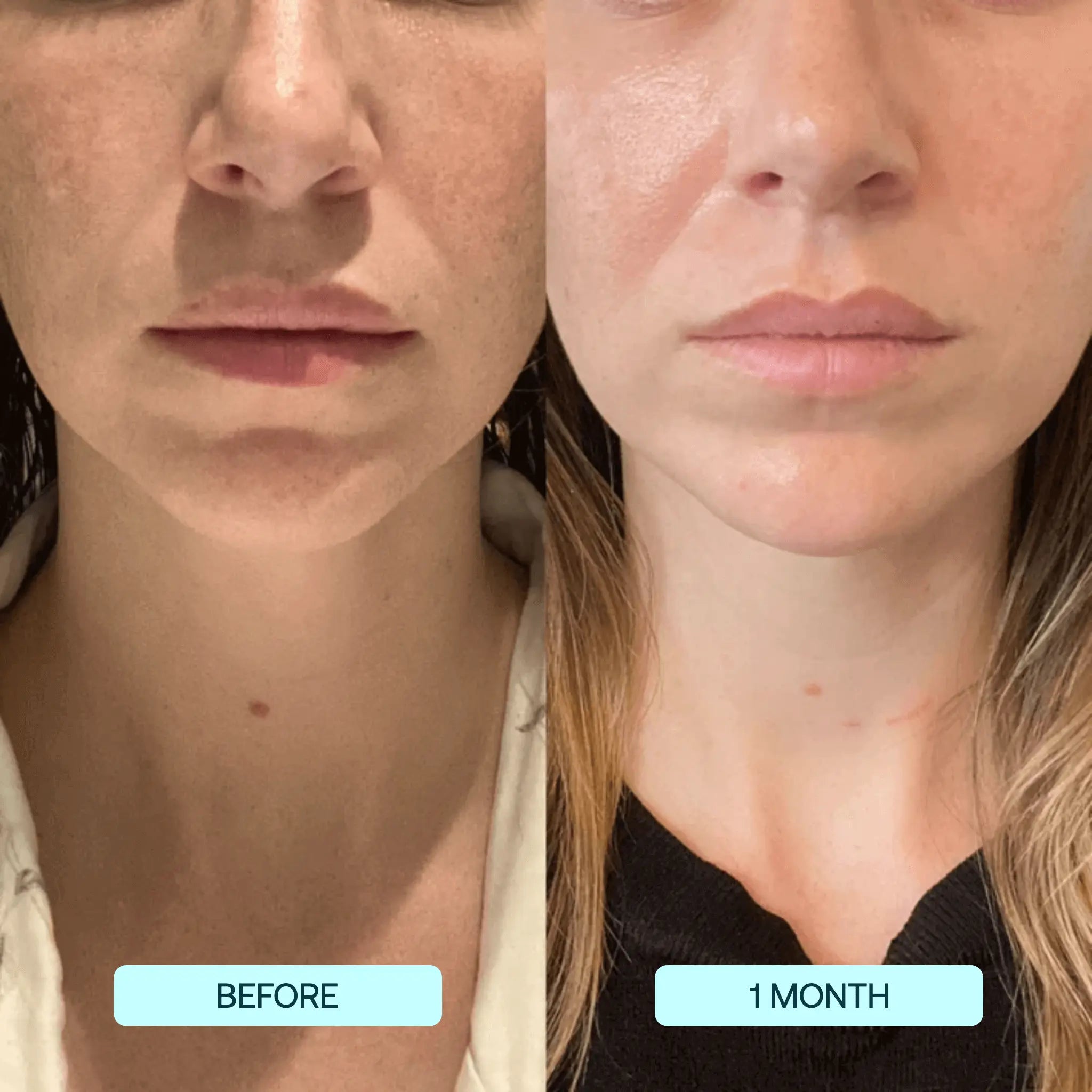 Collagen Films Beaut Fate
