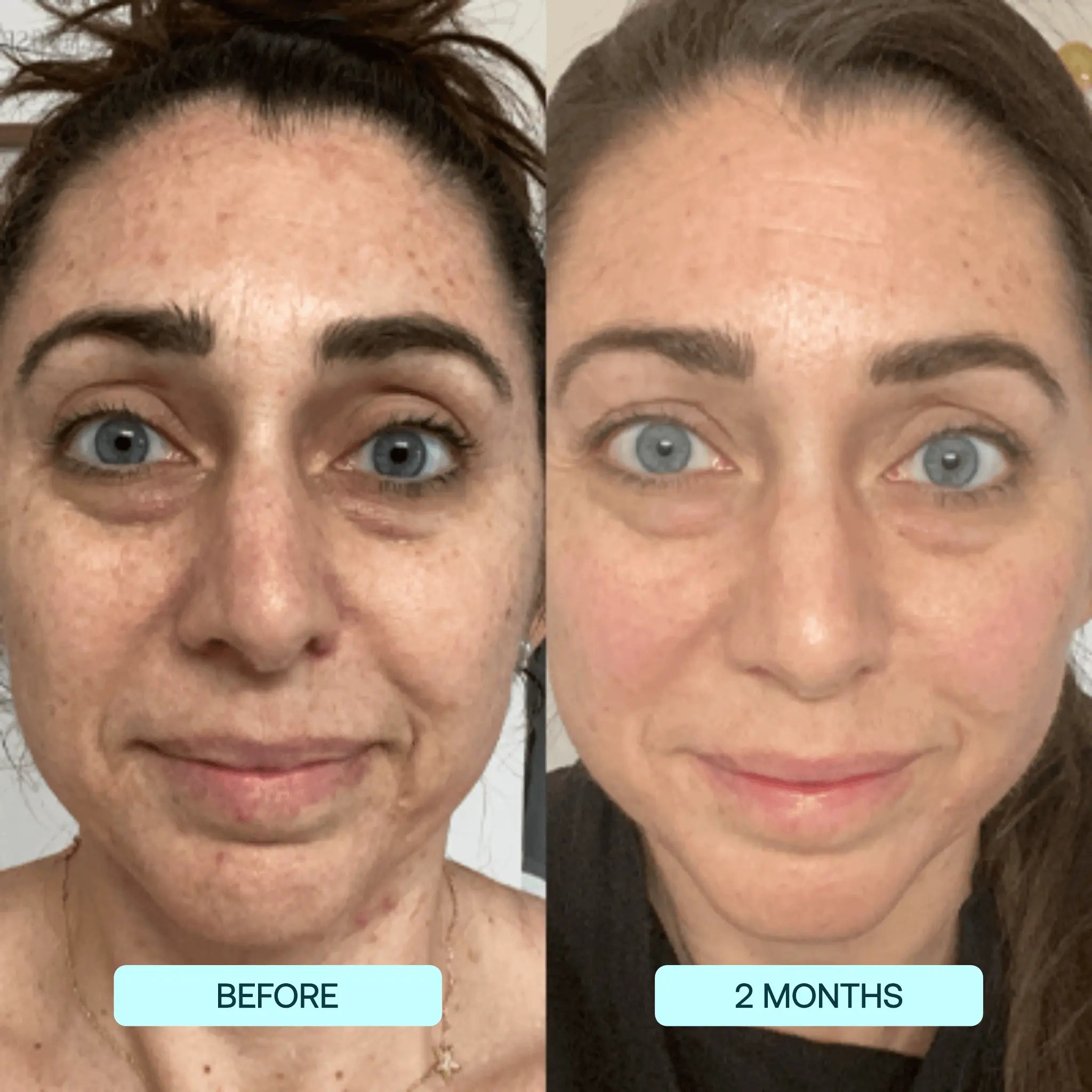 Collagen Films Beaut Fate