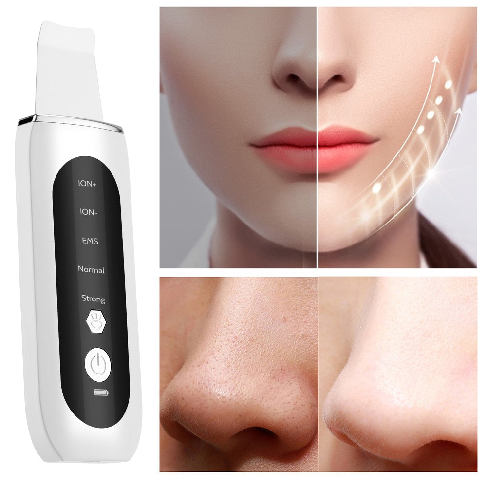 Ultrasonic Face Skin Scrubber Beaut Fate