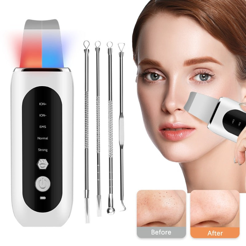 Ultrasonic Face Skin Scrubber Beaut Fate